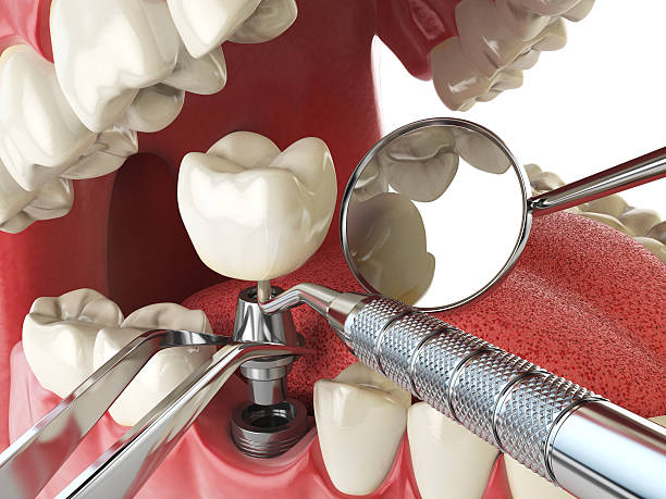 Best Weekend Emergency Dental Services in Timberlake, VA